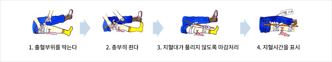 1 출혈부위를 닦는다 2 충분히 죈다 3 지혈대가 풀리지 않도록 마감처리 4 지혈시간을 표시